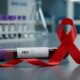 دوره نهفتگی HIV چیست و چرا تشخیص زودهنگام آن اهمیت دارد؟